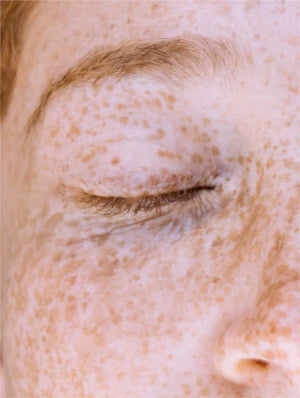 Serum de Vitamina C - Ryoho Cosmetics